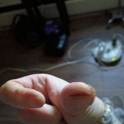 MedNOW Clinics - Still waiting for my records. got an email for a ROI except it's in read mode only! Those cuts on my thumbs are so painful!