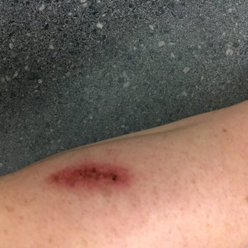 Spoon - Please be careful. I got a third-degree burn from lightly tapping the side of the dolsot bowl! - Korean Near Me - Berkeley, California Spoon - Please be careful. I got a third-degree burn from lightly tapping the side of the dolsot bowl! - Korean Near Me - Berkeley, California