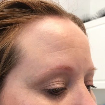 Feign Beauty - sad before photo - NO brows! - Permanent Makeup Near Me - Pasadena, California Feign Beauty - sad before photo - NO brows! - Permanent Makeup Near Me - Pasadena, California