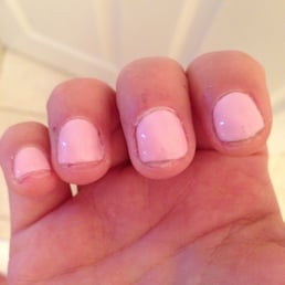 Gel manicure. Nails were cut so short that nail bed was exposed.