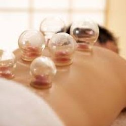 Breathing Hands Wellness and Acupuncture PLC - Cupping therapy