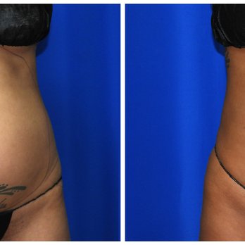 HOUSTON LIPO CENTER - Updated May 2026 - 121 Photos - 1941 W T C Jester  Blvd, Houston, Texas - Cosmetic Surgeons - Phone Number