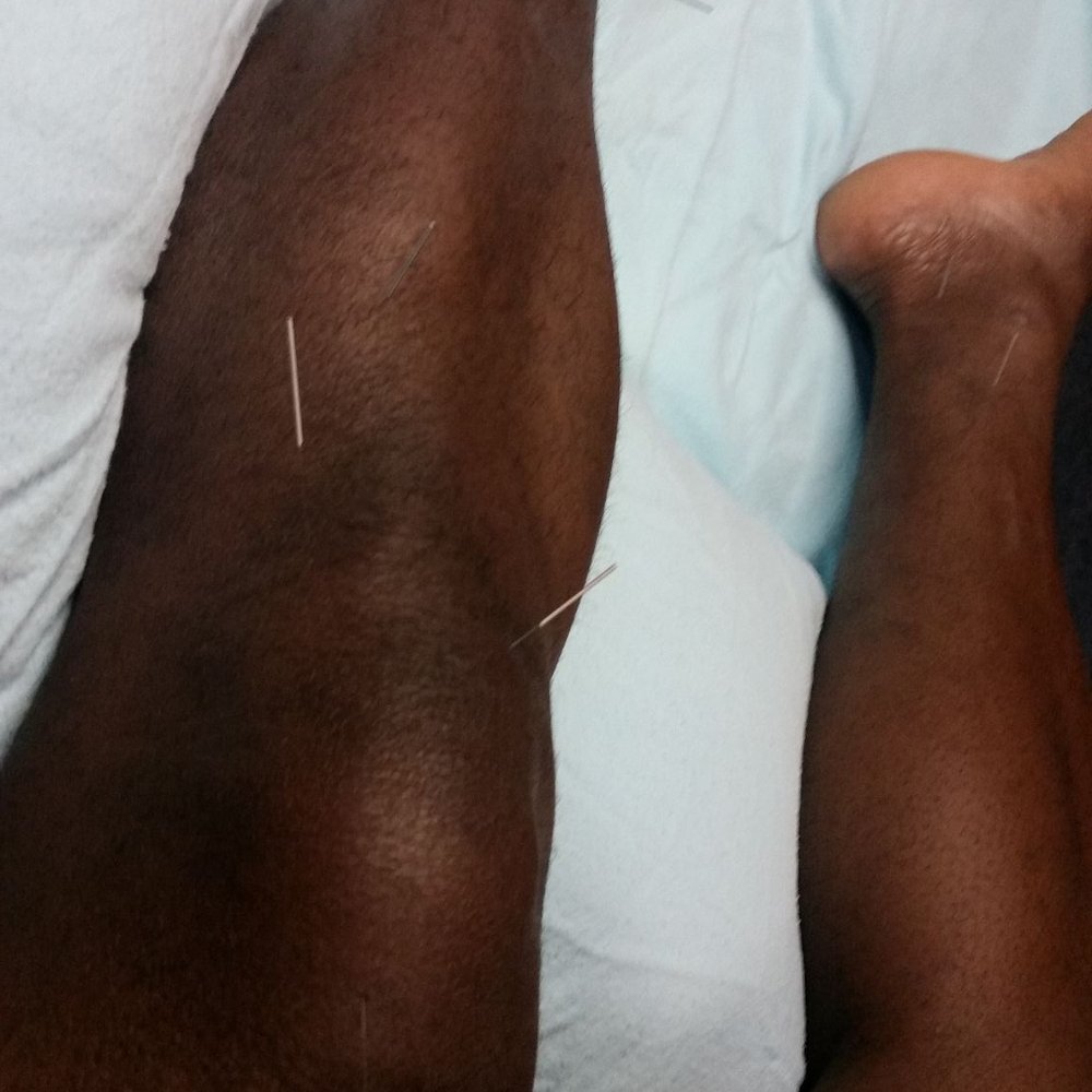 Insight Health Center - Acupuncture Near Me - Aurora, Colorado Insight Health Center - Acupuncture Near Me - Aurora, Colorado
