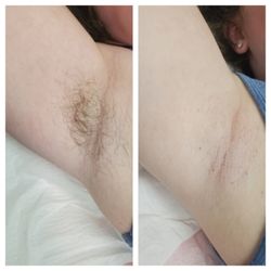 Eyebrows By Corrina - Sugaring Hair Removal