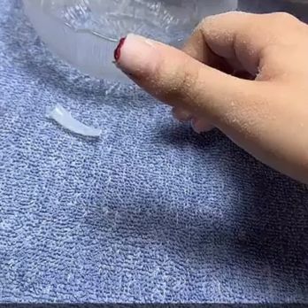 Vn Nails - Cut the tip of my thumb off - Nail Salons Near Me - Hurst, Texas Vn Nails - Cut the tip of my thumb off - Nail Salons Near Me - Hurst, Texas