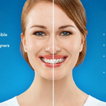 Mason Yeary, DDS - Plano Smiles - Dr. Yeary is an Invisalign provider. - Cosmetic Dentists Near Me - Plano, Texas Mason Yeary, DDS - Plano Smiles - Dr. Yeary is an Invisalign provider. - Cosmetic Dentists Near Me - Plano, Texas