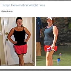 Tampa Rejuvenation - Westchase - Tampa Rejuvenation Testimonial