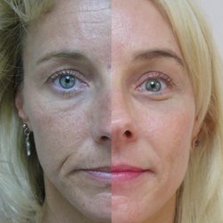 Armenta Rick MD - Let the real resuts tell you the difference,do not  be fooled by retoched model images.