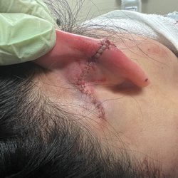 Behavioral Hospital of Bellaire - I'd show you the before, but they'd be removed by Yelp bc they're so gruesome