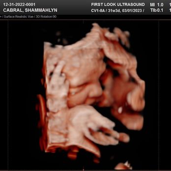 First Look Ultrasound - Diagnostic Imaging Near Me - Kaneohe, Hawaii