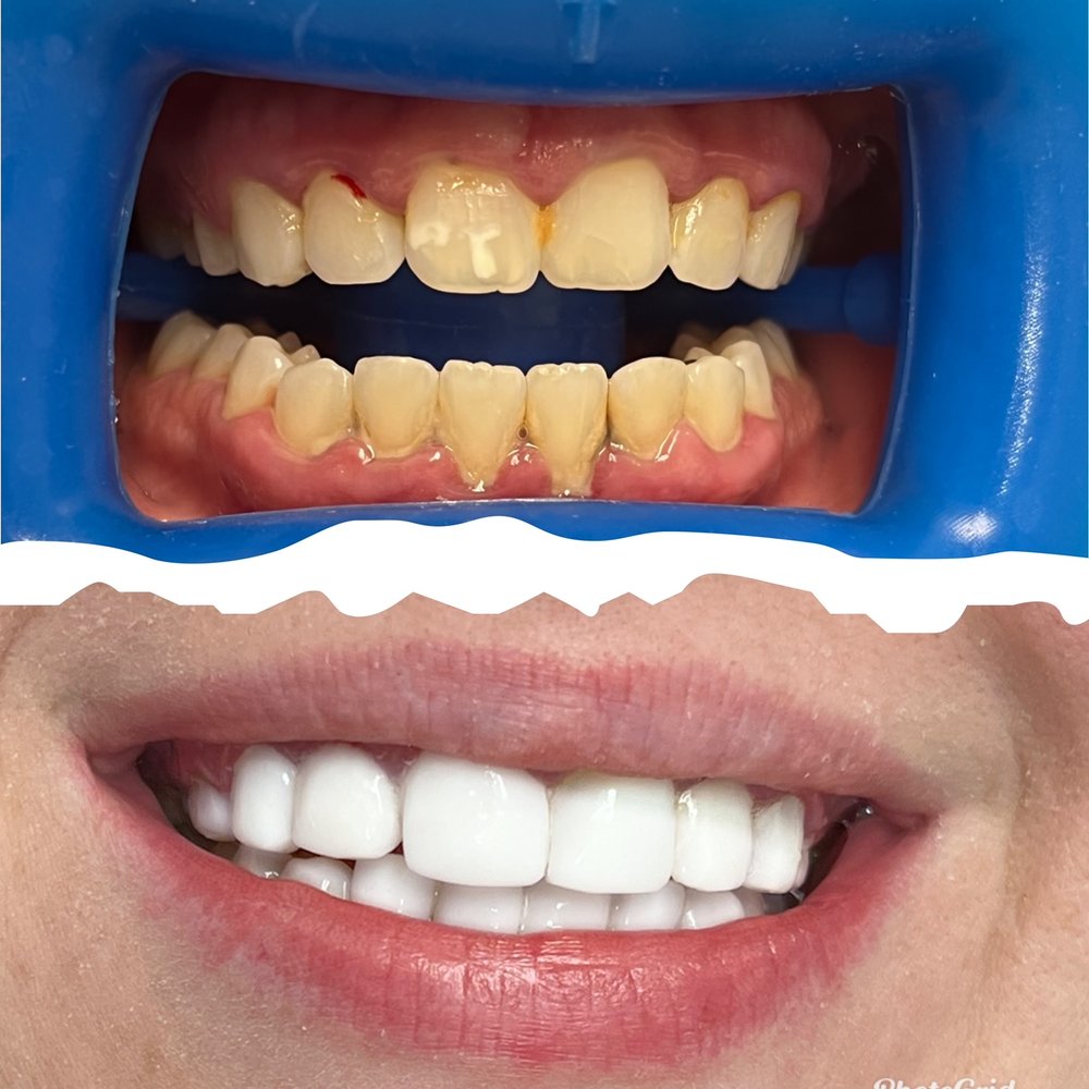 CHICAGOS BEST SMILE 519 S Bartlett, Streamwood, Illinois Teeth