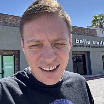 Bella Smiles - Fixed my front tooth that was chipped. Quick, easy, painless!! - Cosmetic Dentists Near Me - Las Vegas, Nevada Bella Smiles - Fixed my front tooth that was chipped. Quick, easy, painless!! - Cosmetic Dentists Near Me - Las Vegas, Nevada