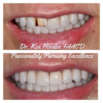 Kenneth Hovden, DDS - Cosmetic Dentists Near Me - Daly City, California