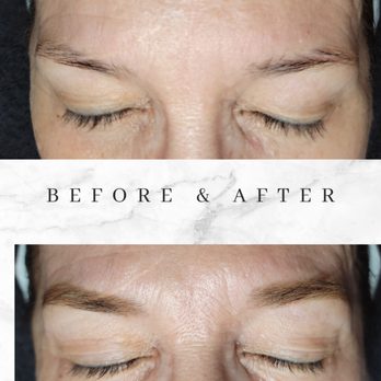 Aeris Skin & Beauty - Brow henna over scar. - Permanent Makeup Near Me - Carmichael, California Aeris Skin & Beauty - Brow henna over scar. - Permanent Makeup Near Me - Carmichael, California