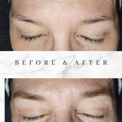 Aeris Skin & Beauty - Brow henna over scar.