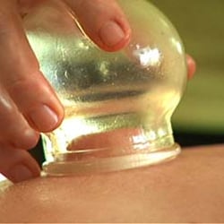 Macrobiotic Academy USA - Hijama , wet cupping