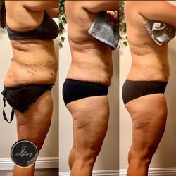 Illuminae Contour + Detox - Before/after