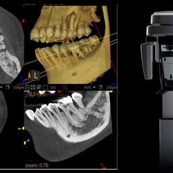Ali Haeri, DMD, MHS Periodontist and Dental Implant Specialist - 3D Scan with our CBCT Scanner.