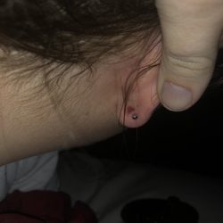 Paris Ink - Ear clamp bruise