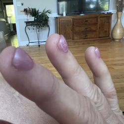 Day 5 I can almost notice coming up over my nail bed very slight