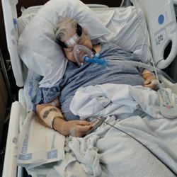 Northwest Medical Center - Then was forced into using a machine because the oxygen tubes were making her nose bleed