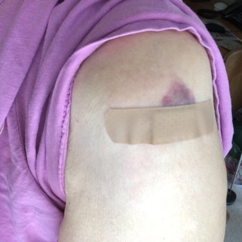 CVS Pharmacy - a woman with a wound on her arm - Drugstores Near Me - San Diego, California