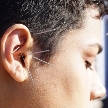 Joyce Leung Acupuncture - Ear acupuncture for relaxation & detoxification. - Acupuncture Near Me - Newburgh, New York Joyce Leung Acupuncture - Ear acupuncture for relaxation & detoxification. - Acupuncture Near Me - Newburgh, New York
