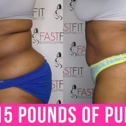 Fast Fit Body Sculpting - Fast Fit Body Sculpting Fat Weight Loss Review Before and After Skin Tightening