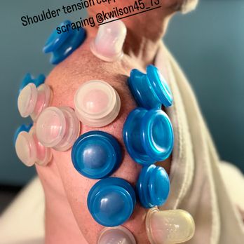 Rhonda Wilson's Healing Hands Spa - Cupping therapy helps improve muscle circulation, increase range of motion, reduce tension, and promote faster recovery. Overall well being - Massage Near Me - Menifee, California Rhonda Wilson's Healing Hands Spa - Cupping therapy helps improve muscle circulation, increase range of motion, reduce tension, and promote faster recovery. Overall well being - Massage Near Me - Menifee, California