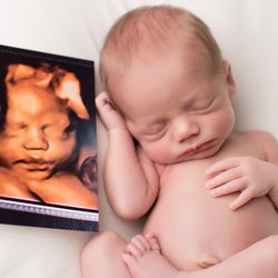 My Baby You'll Be 4d Ultrasound