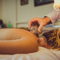 Cupping application
