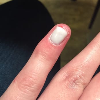 Elegant Nails & Spa - She had my nails raw. - Day Spas Near Me - Lubbock, Texas Elegant Nails & Spa - She had my nails raw. - Day Spas Near Me - Lubbock, Texas
