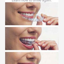 Danvers Dental Wellness - Call today to schedule your Complimentary Orthodontic Consultation.
Danvers Dental Wellness offers Invisalign and traditional braces.