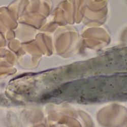 The Green Herb - A live picture of our blood analysis!