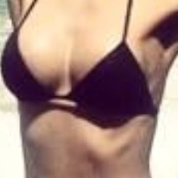 David Kim, MD - 7 months post op! - Cosmetic Surgeons Near Me - Beverly Hills, California David Kim, MD - 7 months post op! - Cosmetic Surgeons Near Me - Beverly Hills, California