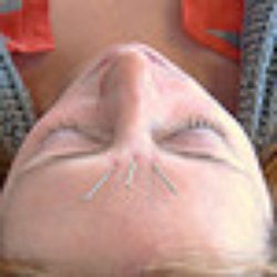Jennifer Nery, Licensed Acupuncturist