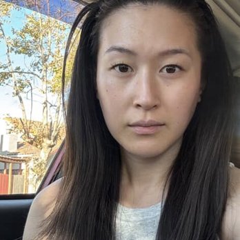 Saelo - 3-months Post-Xeomin, 2-months Post-Oligio  (October 2025) - Skin Care Near Me - San Francisco, California