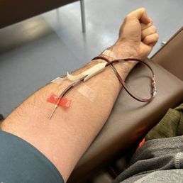 My arm My arm