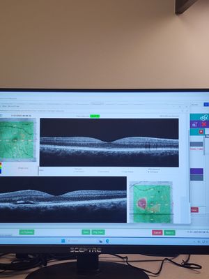 Berkeley Eye Center - Memorial