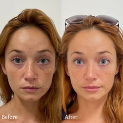 Beauty Cult - Undereye Filler