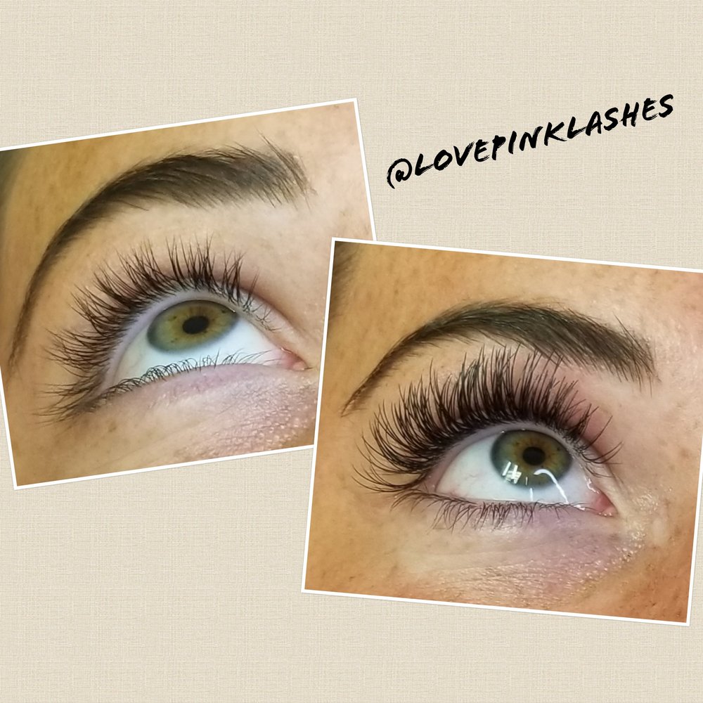 SKIN SAVVY ESTHETICS 12 Photos 2206 Dell Range Blvd, Cheyenne, WY