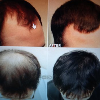 Radiant and Young Skin - PRP hair restoration - Day Spas Near Me - Katy, Texas Radiant and Young Skin - PRP hair restoration - Day Spas Near Me - Katy, Texas