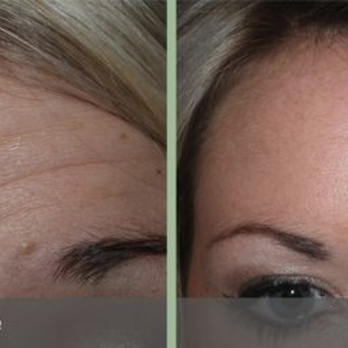 Let's Face It By Vicki - Medical Spas Near Me - Lebanon, Tennessee