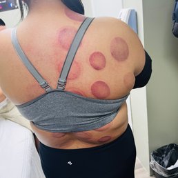 Cupping, included with our membership Cupping, included with our membership
