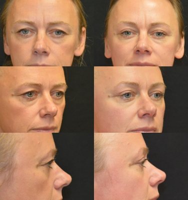 Baroody Plastic Surgery by null