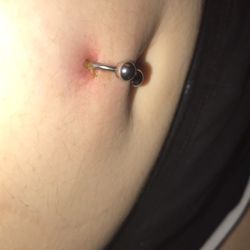 Doc Burns - Nocturnal Body Art - Infected piercing
