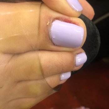 Lucky Nails - Bloody toes - Nail Salons Near Me - South Gate, California