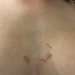 Sharp Shooting Indoor Range & Gun Shop - My burnt chest from a bullet- not happy hurt a lot and when I told them they did not care or offer me assistance