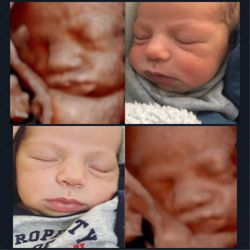 Little Beginnings 4D HD Ultrasound Studio