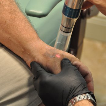 ReversaTatt Tattoo Removal - Tattoo Removal Near Me - Jupiter, Florida ReversaTatt Tattoo Removal - Tattoo Removal Near Me - Jupiter, Florida
